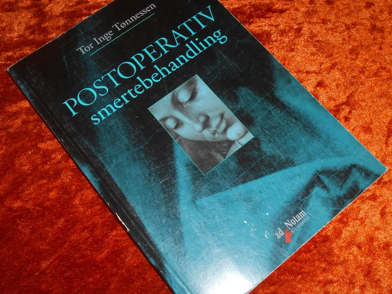 Billede 1 - Postoperativ smertebehandling, Tor Inge Tønnessen