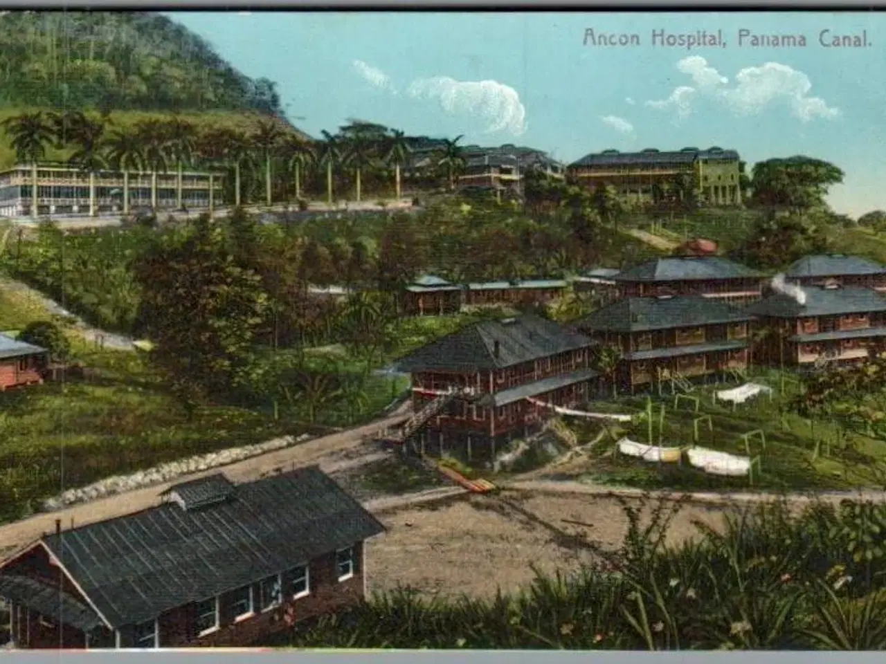 Billede 1 - Ancon Hospital - Panama Canal - Ubrugt