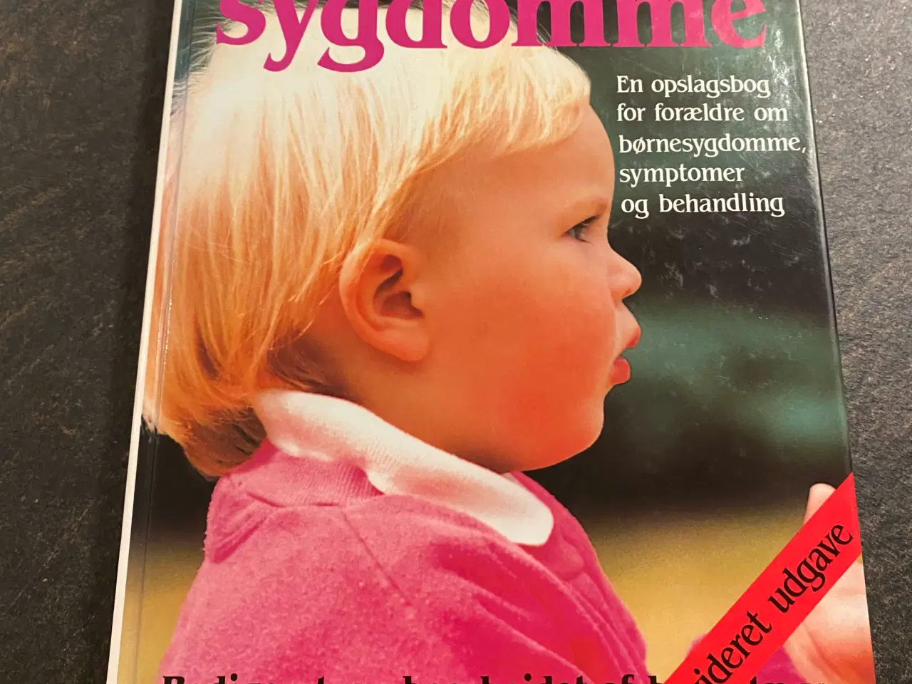 Billede 1 - Barnets sygdomme