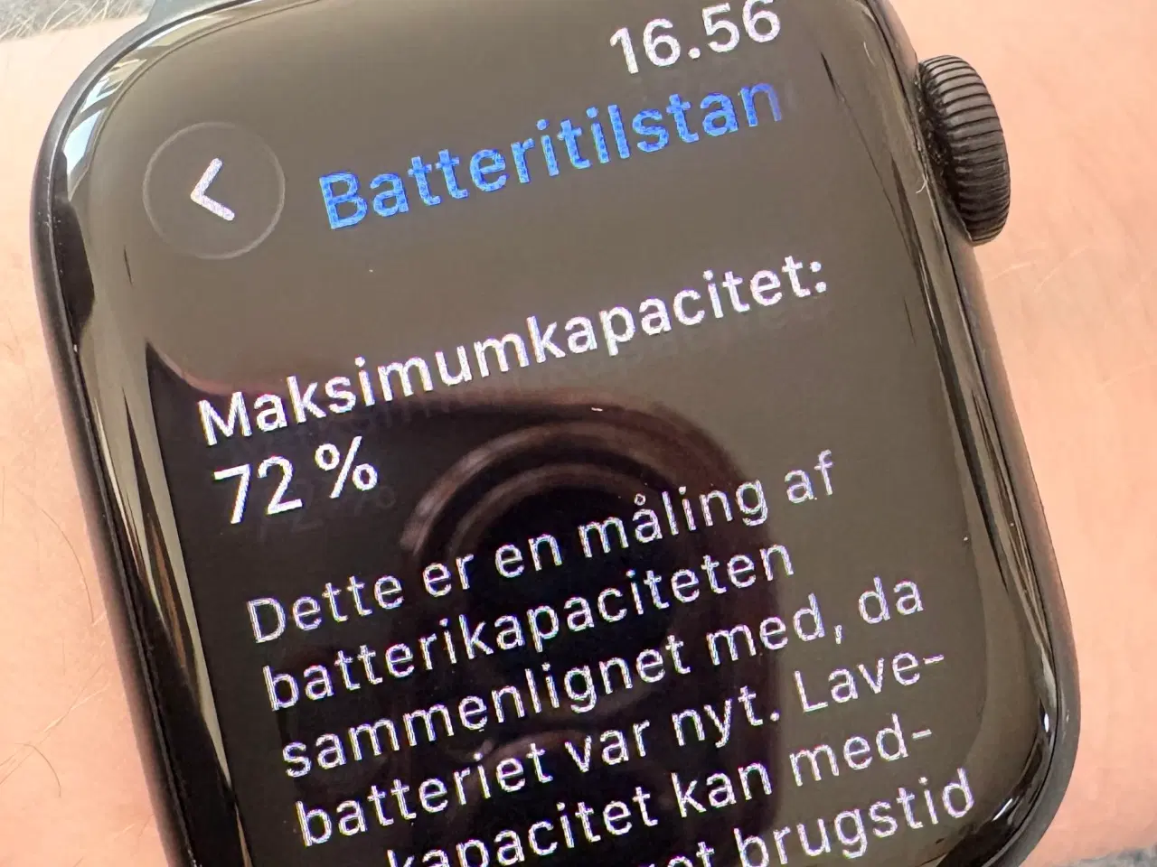 Billede 12 - Apple Watch serie 7 41 mm GPS