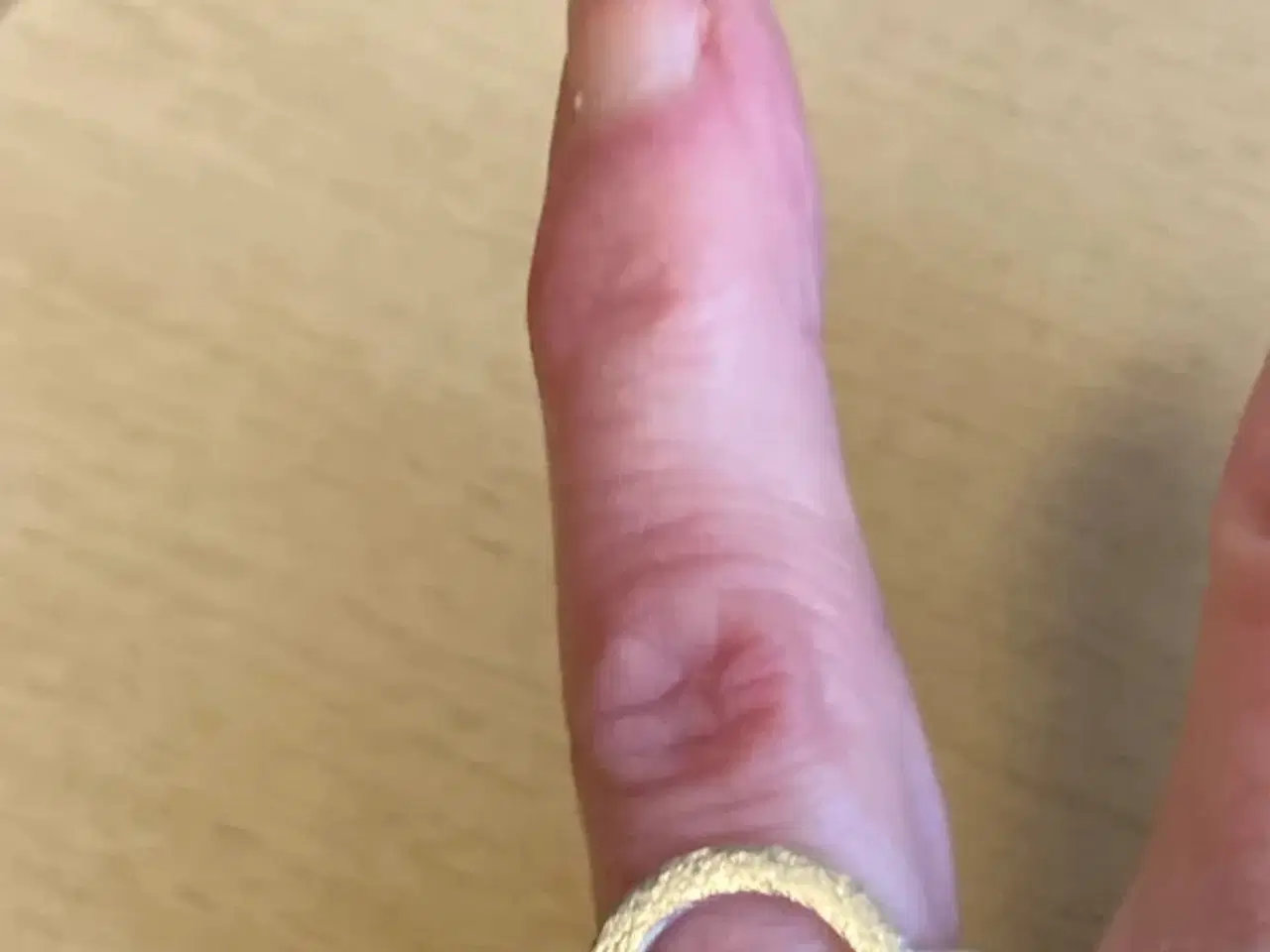 Billede 1 - Finger-ring