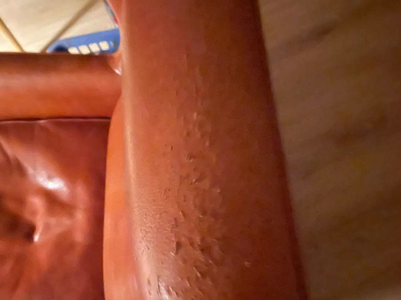 Billede 2 - Øreklapstol 