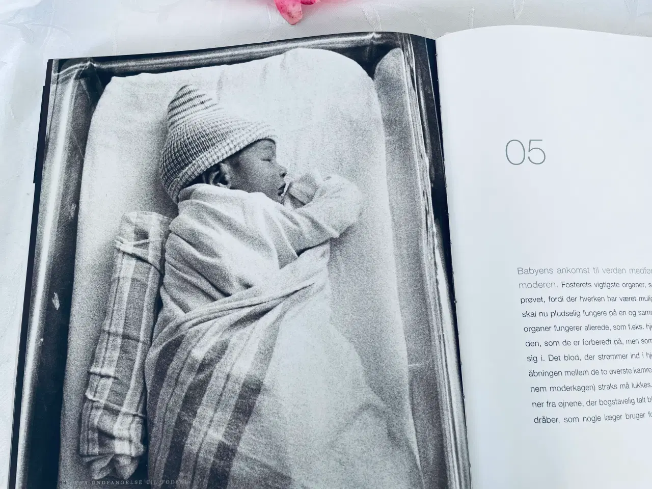 Billede 1 - Fra undfangelse til fødsel