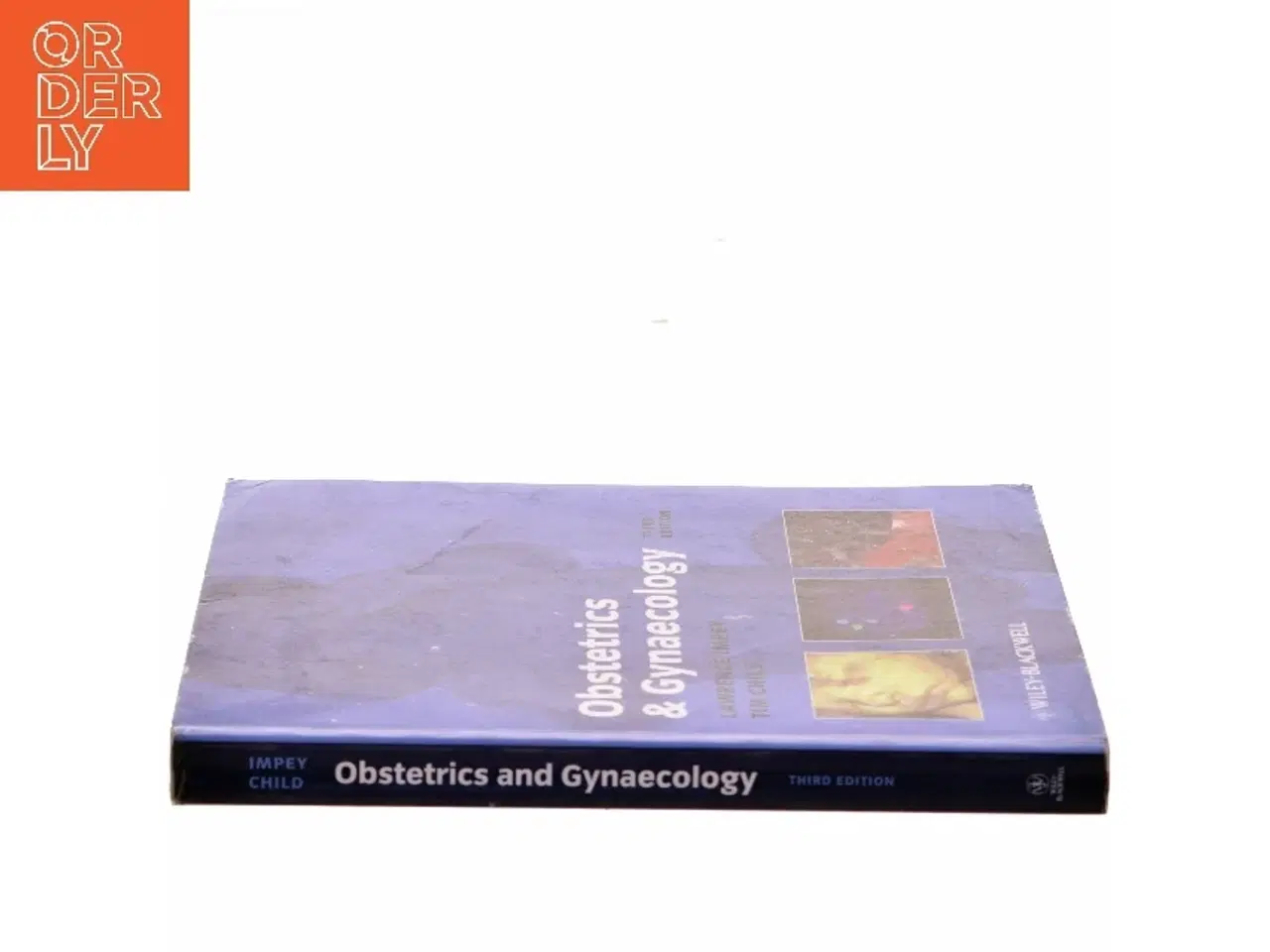 Billede 2 - Obstetrics and Gynaecology by Tim, Impey, Lawrence Child af Lawrence Impey (Bog)