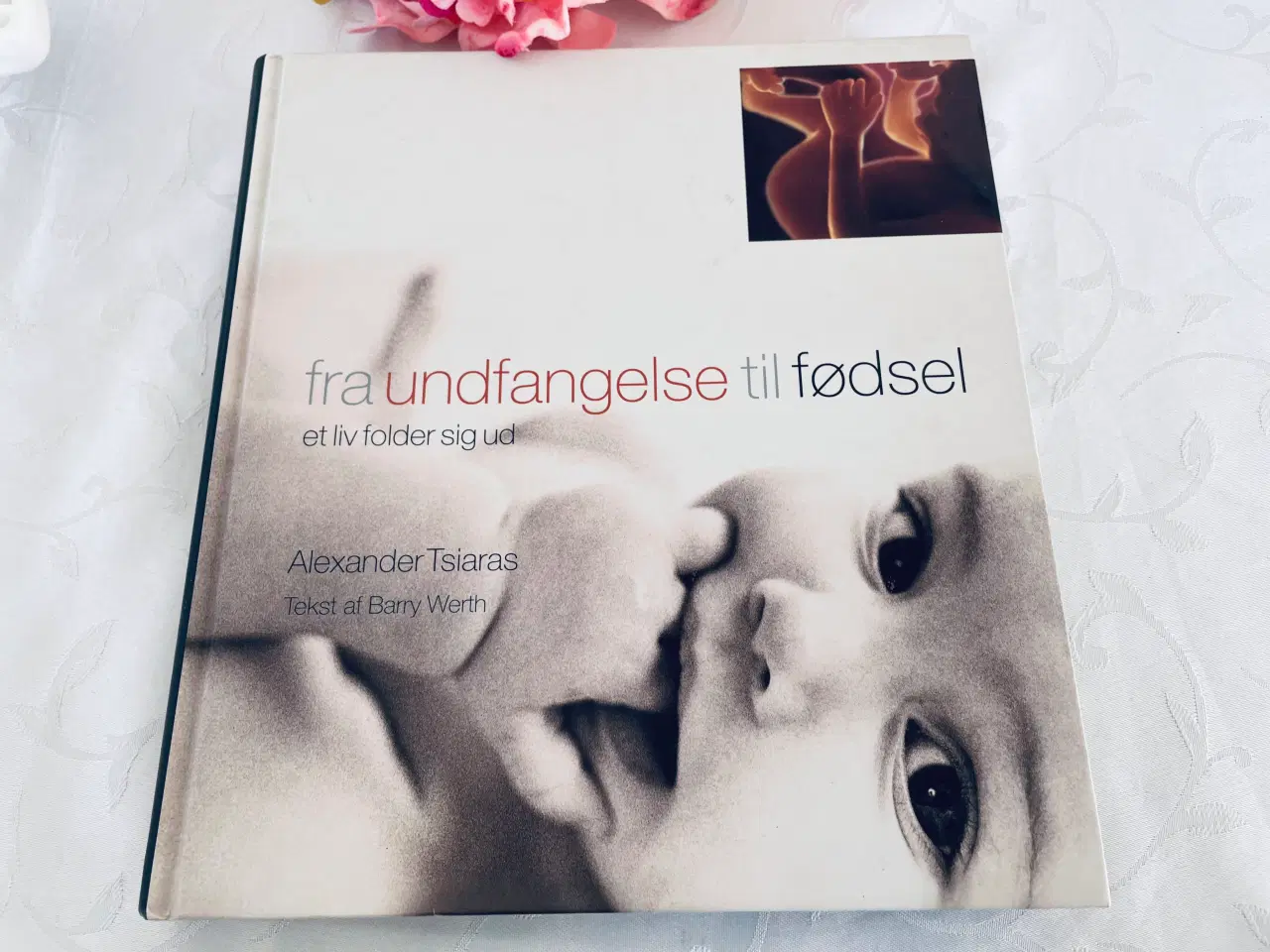 Billede 2 - Fra undfangelse til fødsel