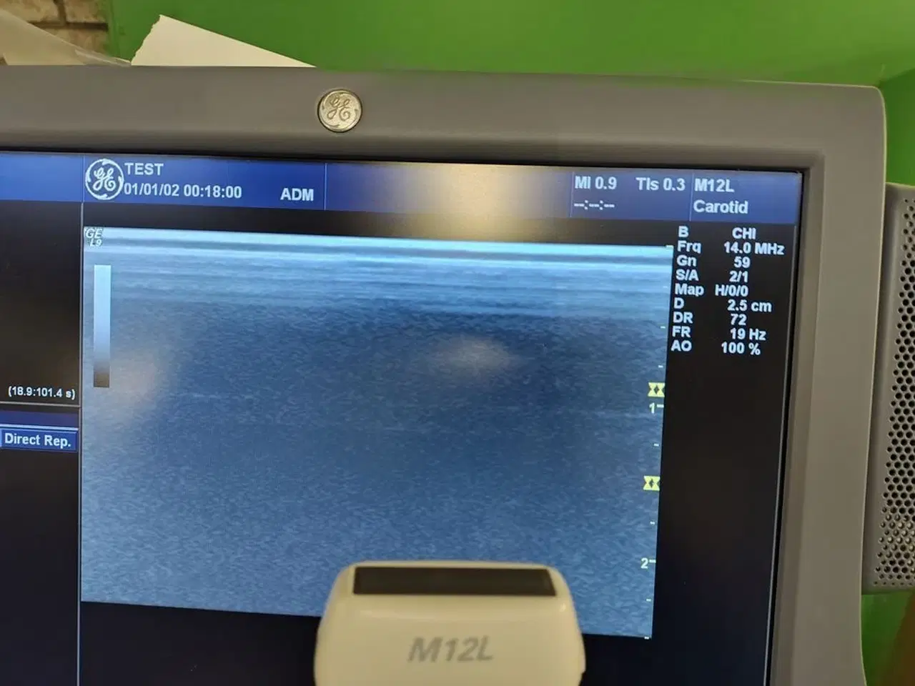 Billede 9 - Ultrasound scanner GE Logiq 9