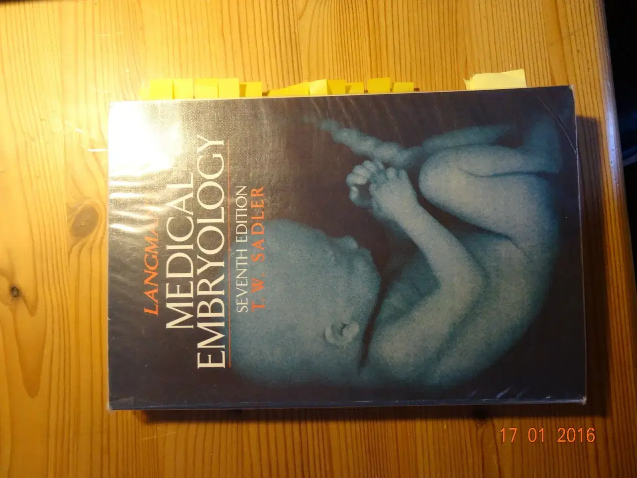 Billede 1 - Medical Embryology, Langman