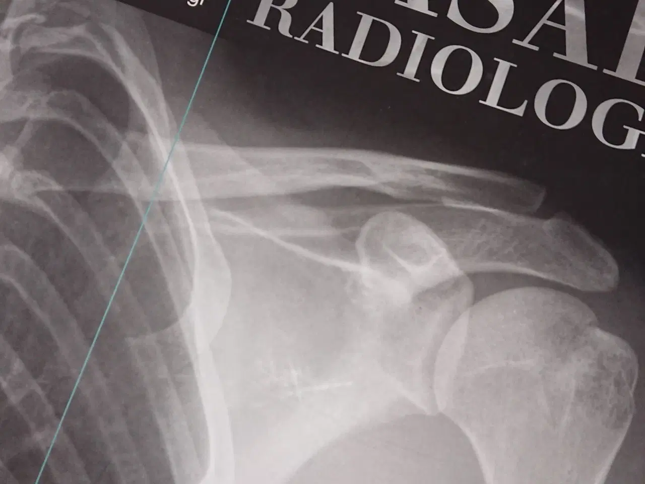 Billede 1 - Basal radiologi