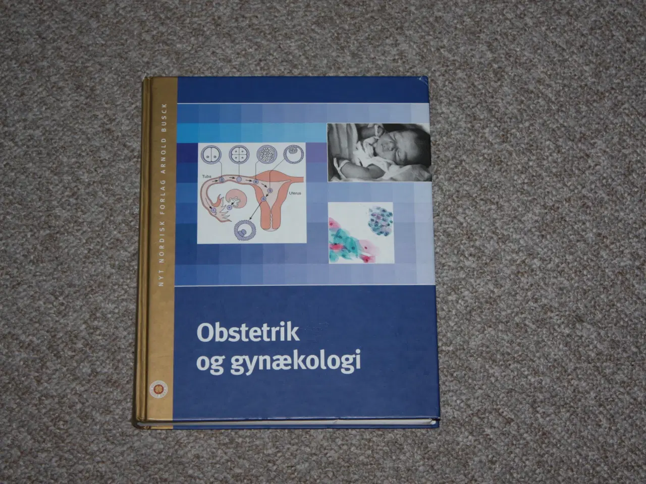 Billede 1 - Obstetrik og gynækologi redaktion Jesper Hertz