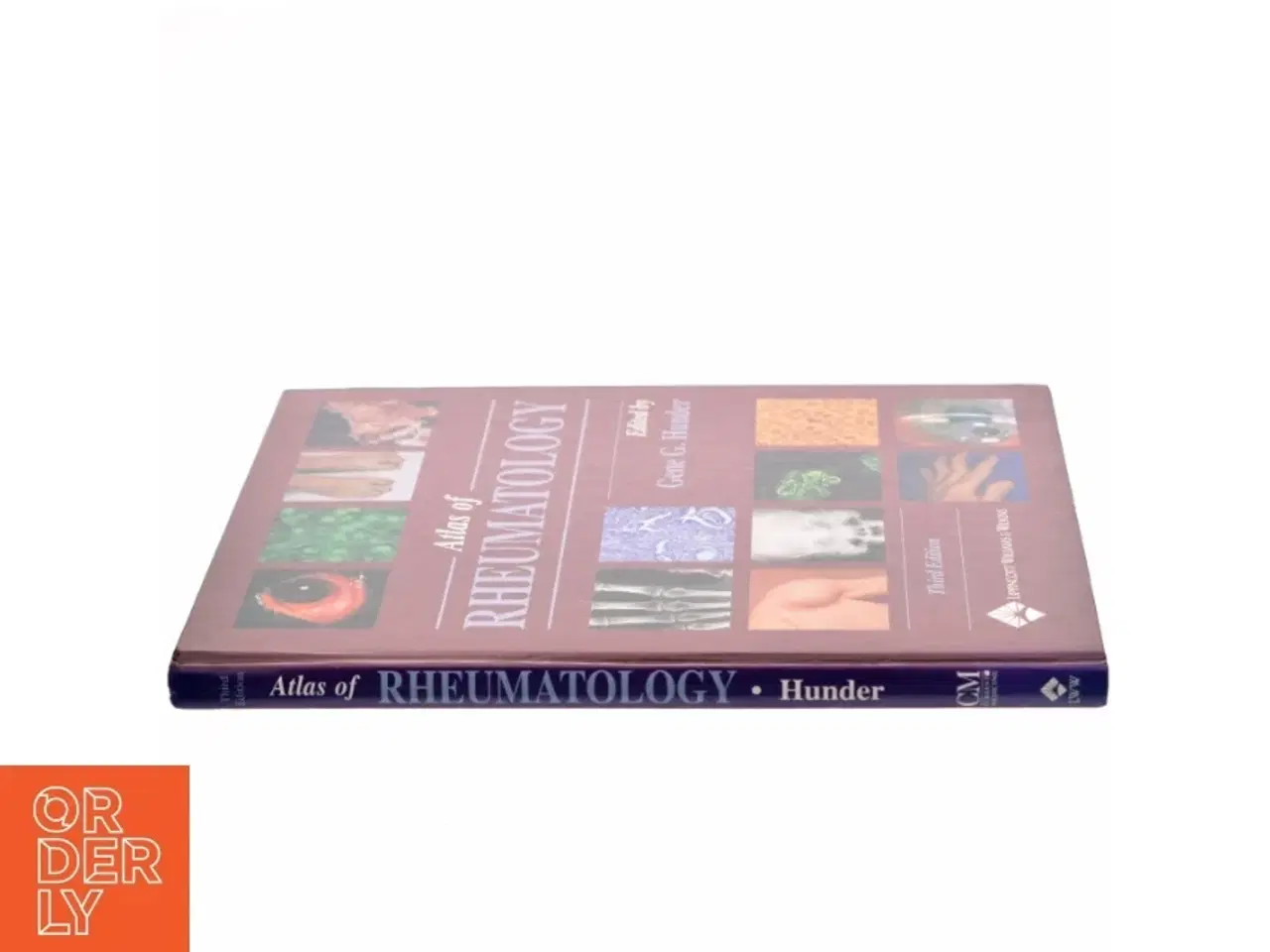 Billede 2 - Atlas of Rheumatology af Gene G. Hunder (Bog)