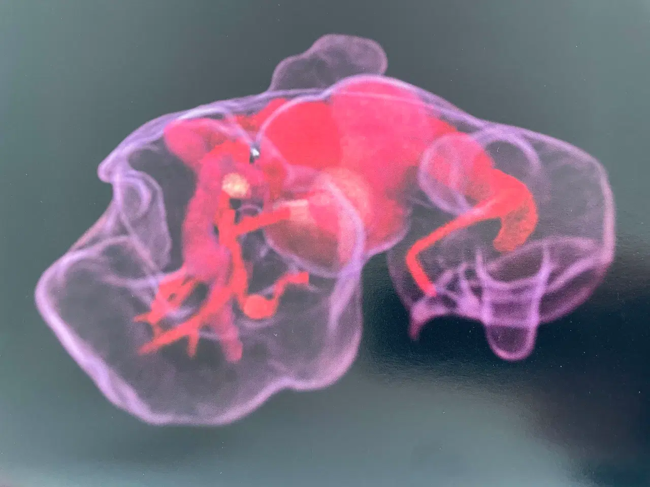 Billede 4 - Fra undfangelse til fødsel