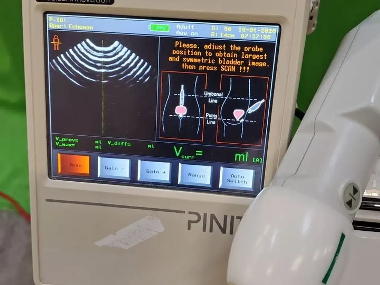 Billede 12 - Bladderscanner PINIT Echoson S255B