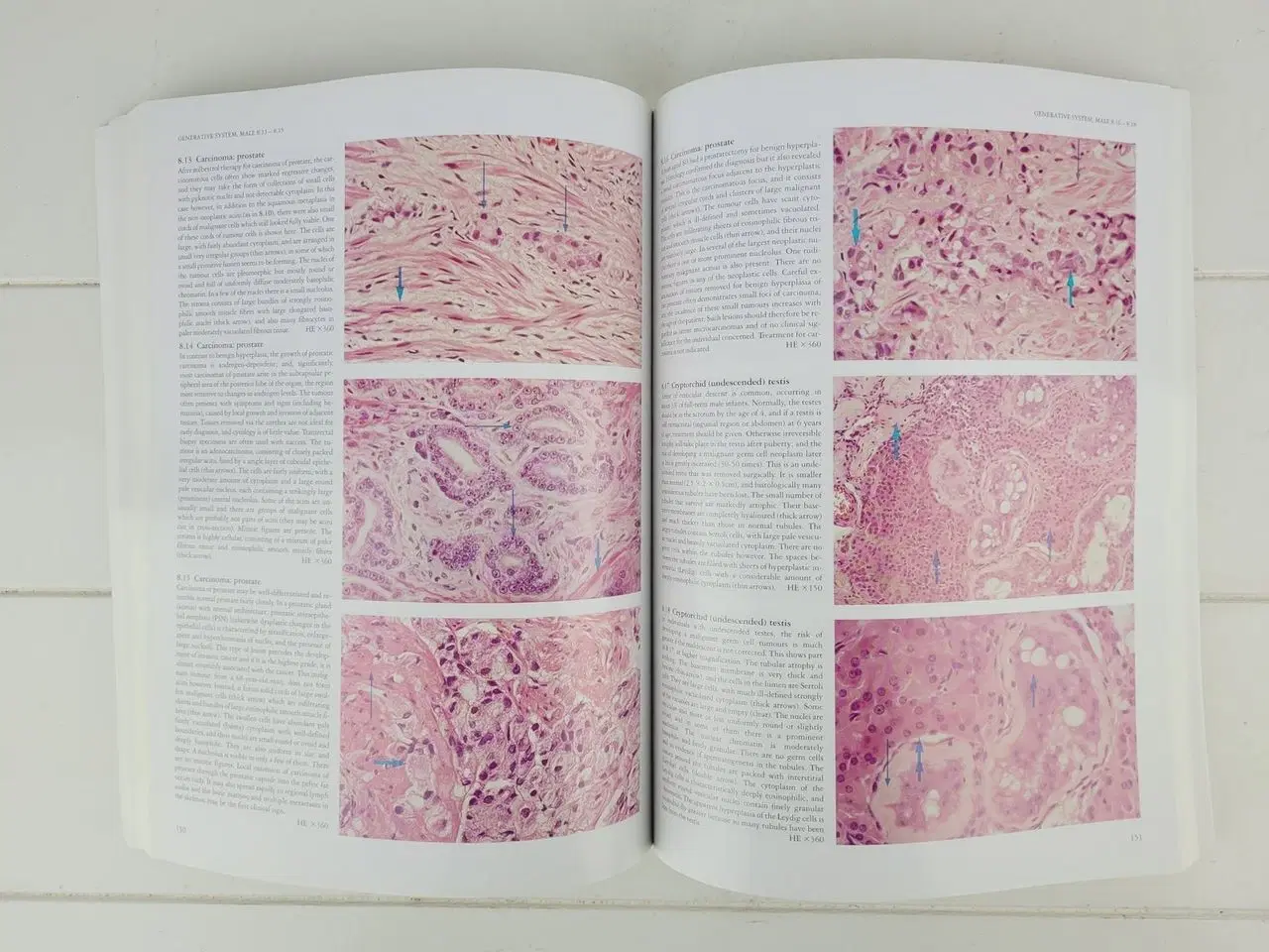 Billede 5 - Curran’s Atlas of Histopathology – 4. udgave  