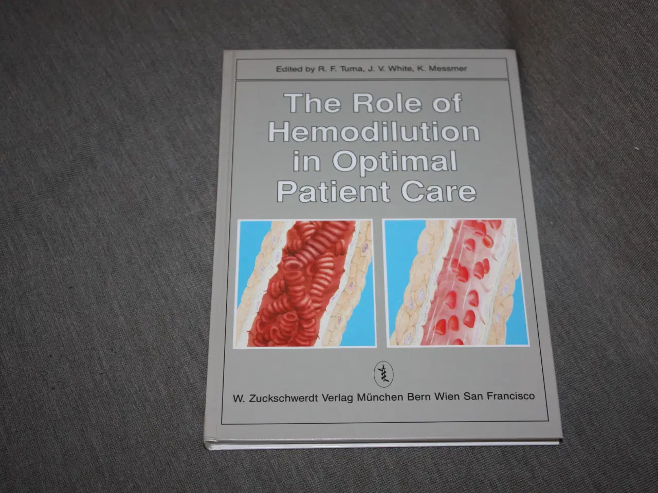 Billede 1 - The role of hemodilution in optimal patient care