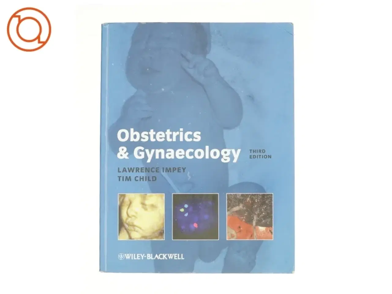 Billede 1 - Obstetrics and Gynaecology by Tim, Impey, Lawrence Child af Lawrence Impey (Bog)