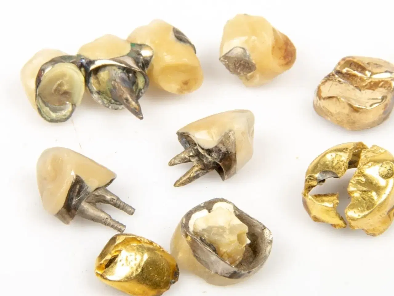 Billede 1 - Guld tænder 