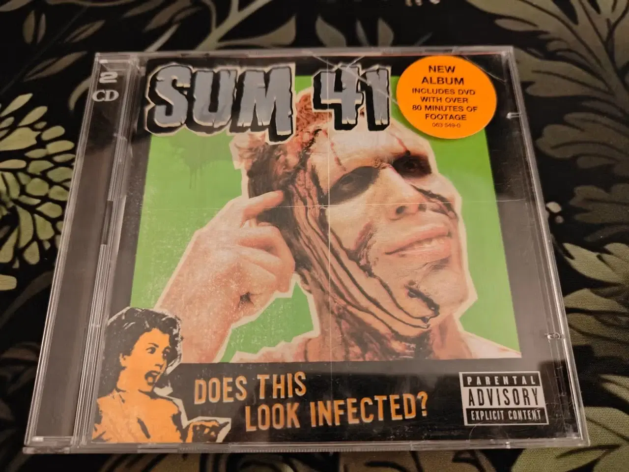 Billede 1 - Sum 41 - Does this look infected?