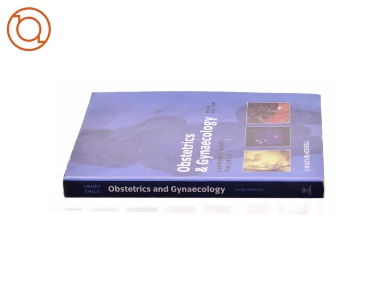 Billede 2 - Obstetrics and Gynaecology by Tim, Impey, Lawrence Child af Lawrence Impey (Bog)