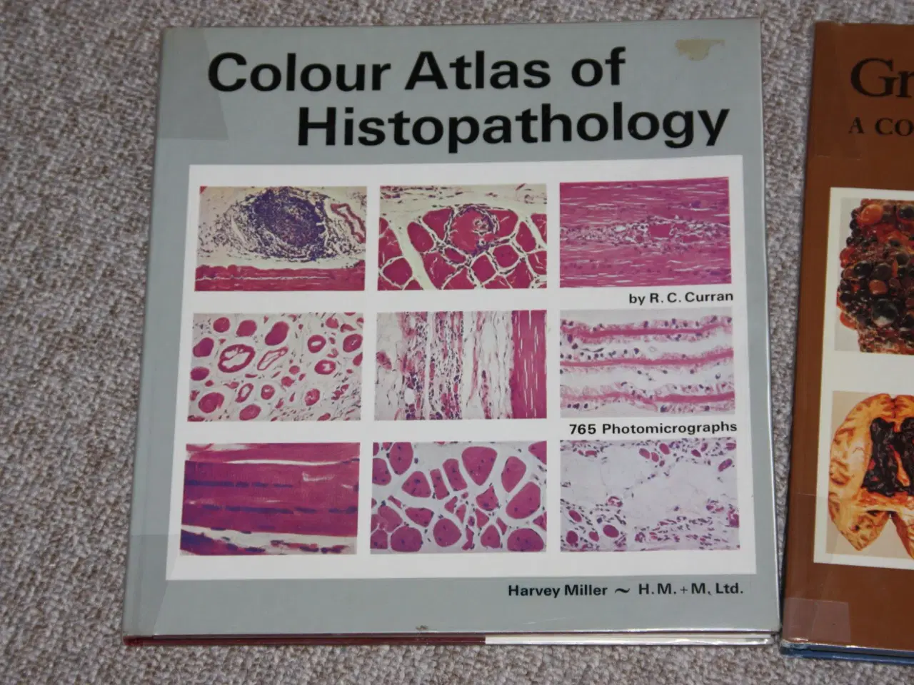Billede 2 - Colour Atlas of Histopathology