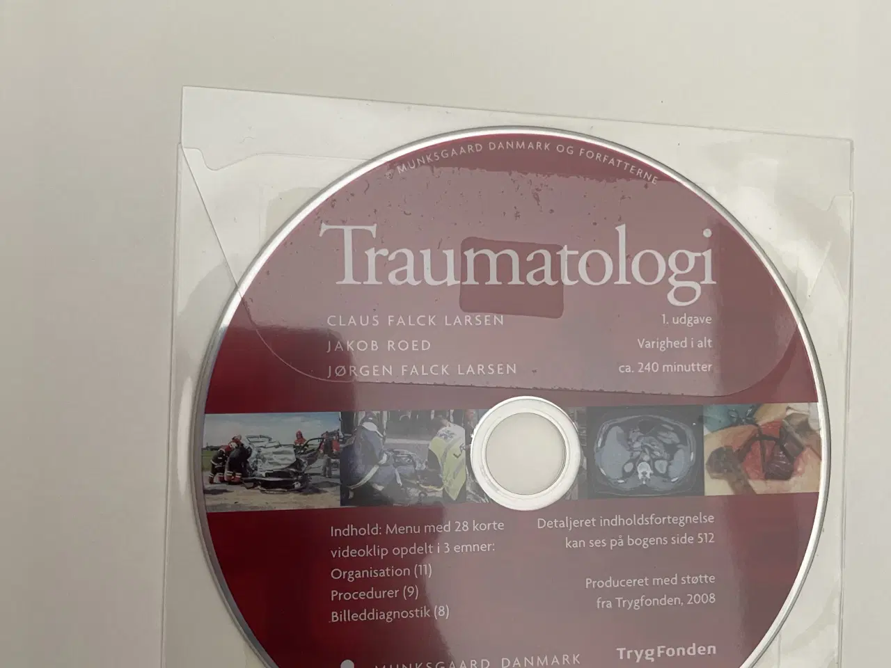 Billede 2 - Traumatologi af Claus Falck Larsen m.fl.