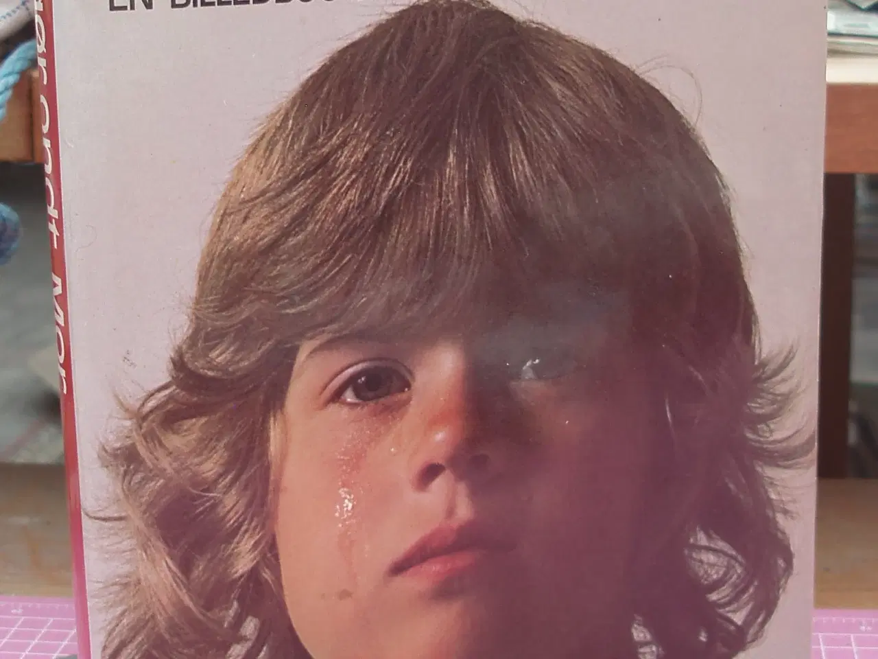 Billede 1 - Det gør ondt mor, en billedbog om barnets sygdomme