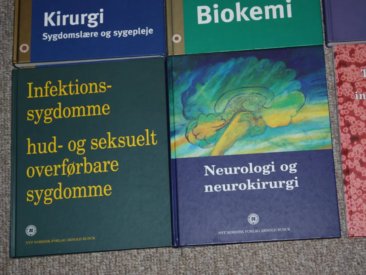 Billede 4 - Kirurgi Sygdomslære og sygepleje Biokemi 