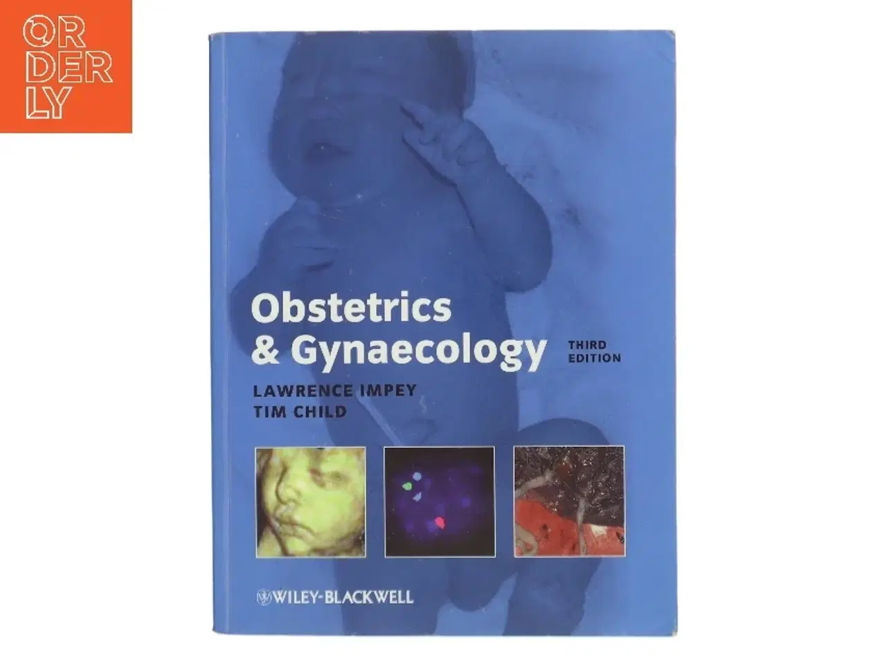 Billede 1 - Obstetrics and Gynaecology by Tim, Impey, Lawrence Child af Lawrence Impey (Bog)
