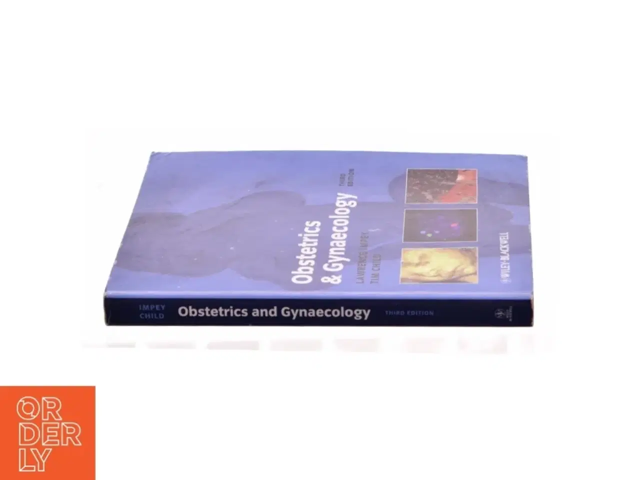 Billede 2 - Obstetrics and Gynaecology by Tim, Impey, Lawrence Child af Lawrence Impey (Bog)