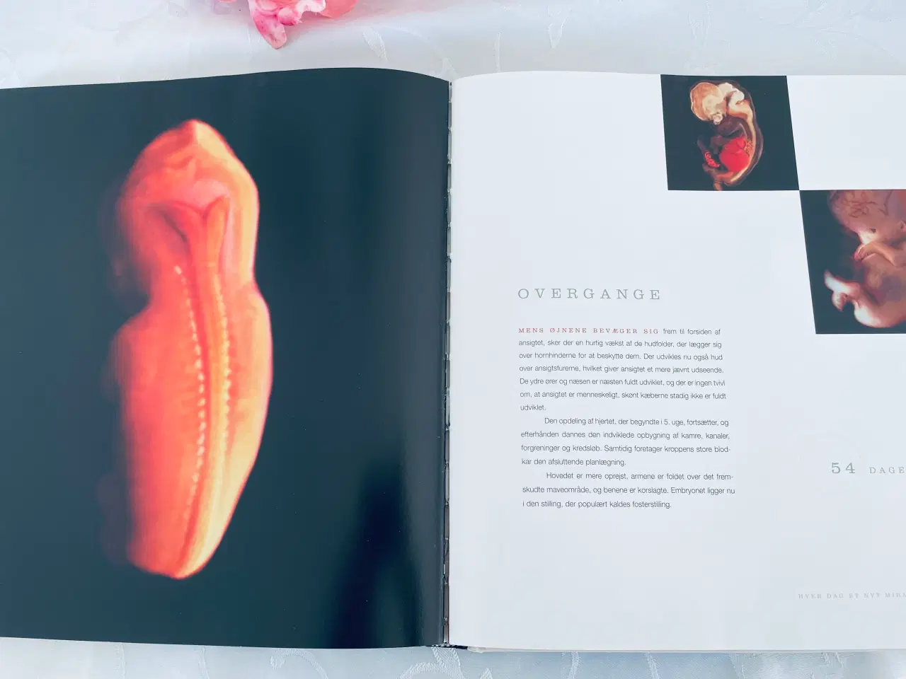 Billede 8 - Fra undfangelse til fødsel