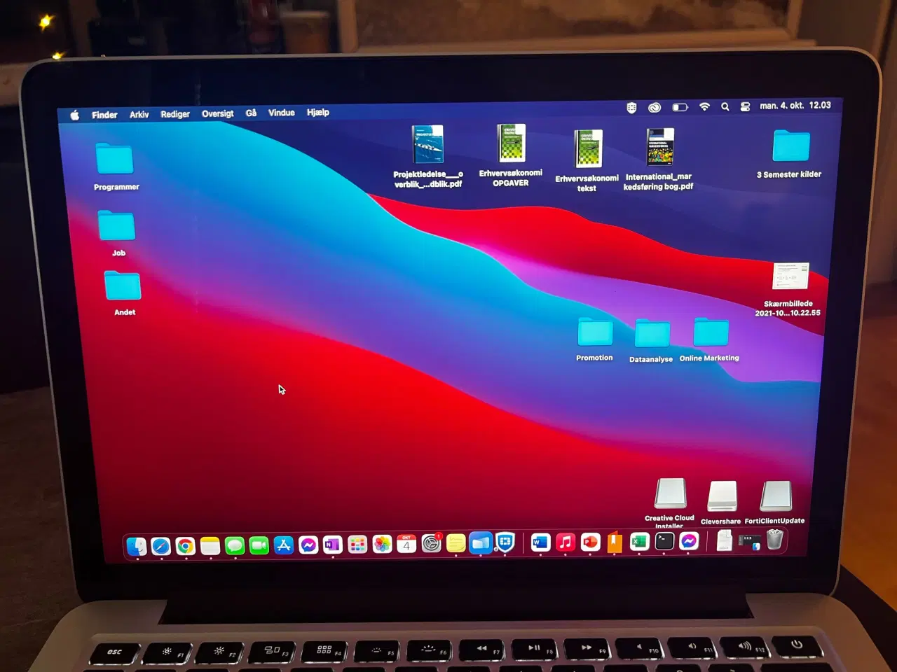 Billede 9 - MacBook pro 13? 2015 model