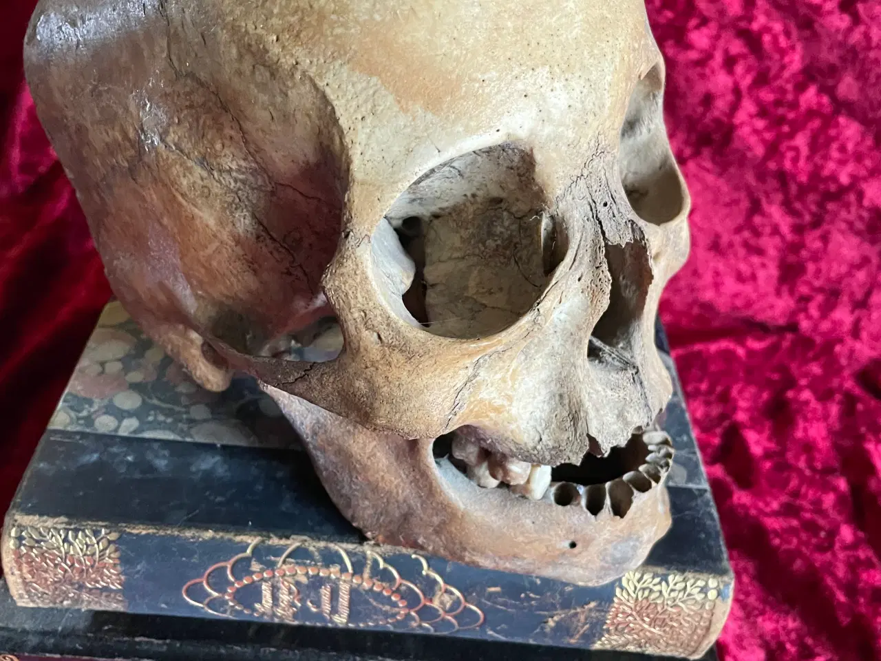 Billede 2 - Kranie, mgt. gammelt fra lægepraksis