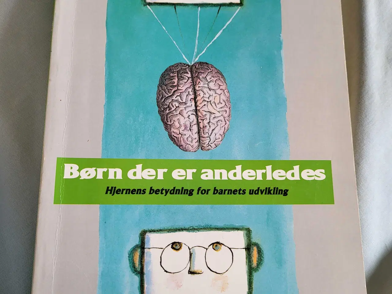 Billede 1 - Børn der er anderledes 
