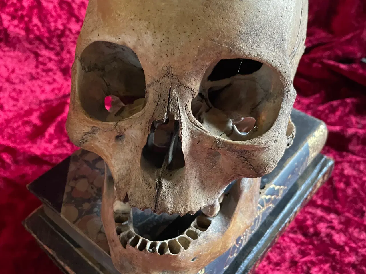 Billede 1 - Kranie, mgt. gammelt fra lægepraksis