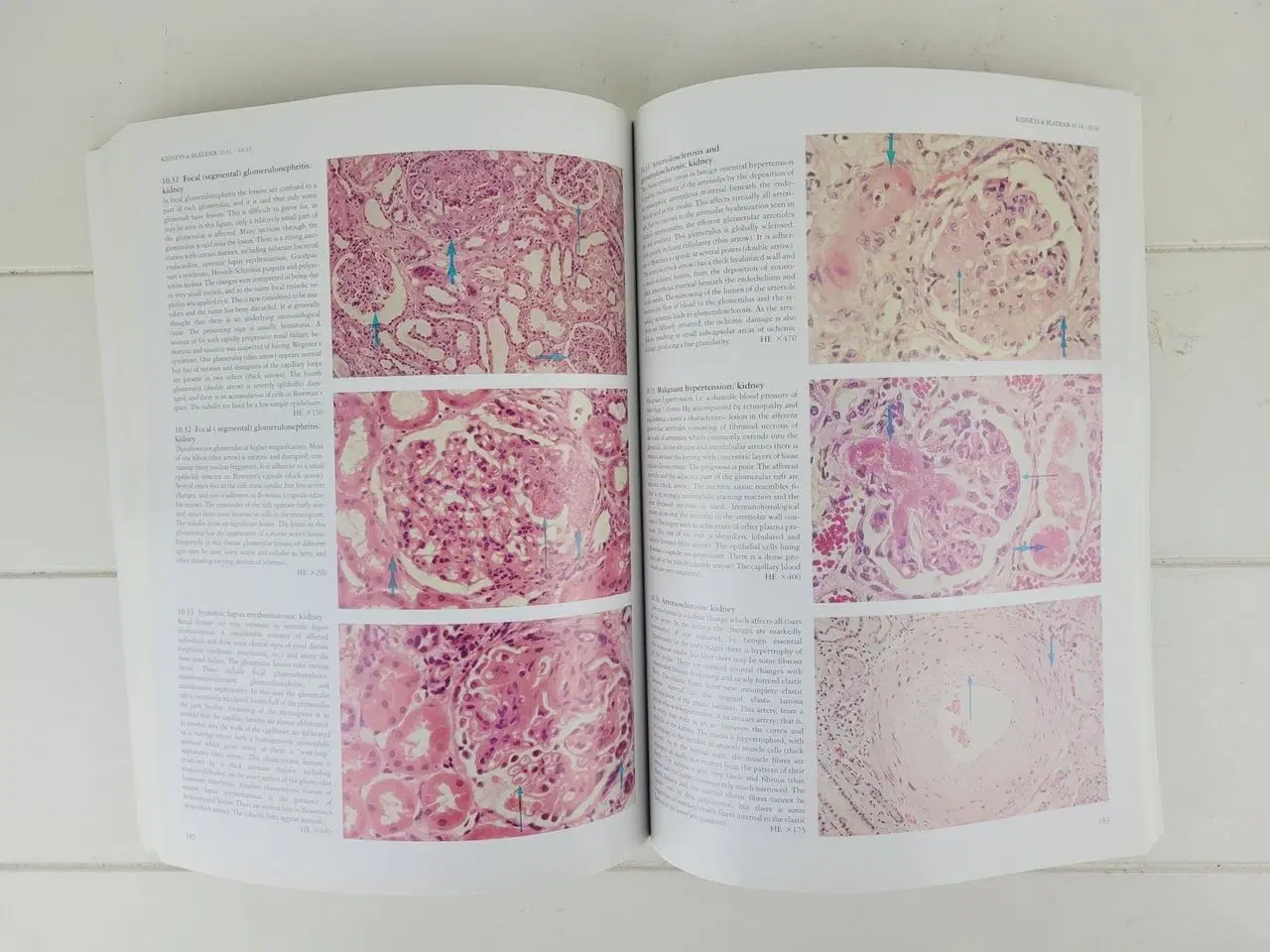 Billede 6 - Curran’s Atlas of Histopathology – 4. udgave  