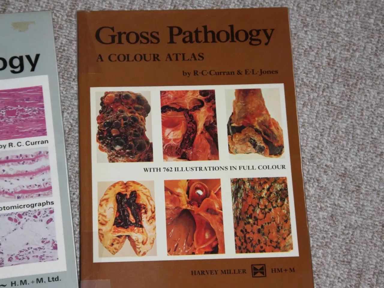 Billede 3 - Colour Atlas of Histopathology