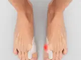 Silikone Bunion Corrector Protector Bunilief  Pakke med 2 stk