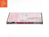 Slumdog Millionaire med Dev Patel (DVD) - 2