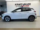 Hyundai Kona 64 EV Xprime+ - 2