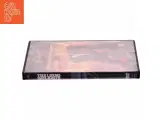 Agent 007 - Living Daylight (DVD) - 2