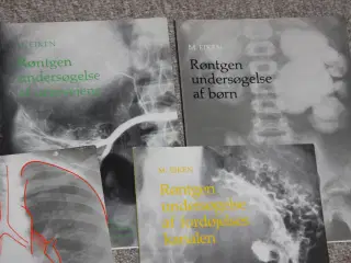 Røntgenundersøgelse af thorax
