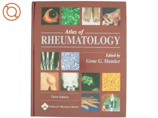 Atlas of Rheumatology af Gene G. Hunder (Bog)