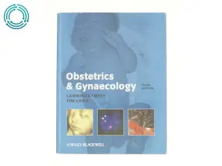 Obstetrics and Gynaecology by Tim, Impey, Lawrence Child af Lawrence Impey (Bog)