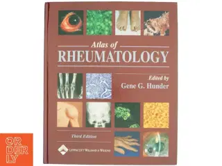 Atlas of Rheumatology af Gene G. Hunder (Bog)